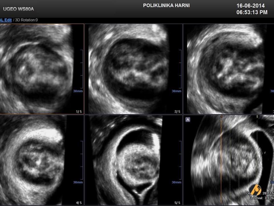 uzv-miom-pregled-3.jpg