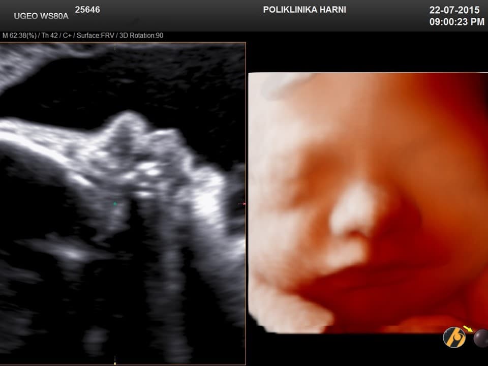 2-uzv-35.jpg
