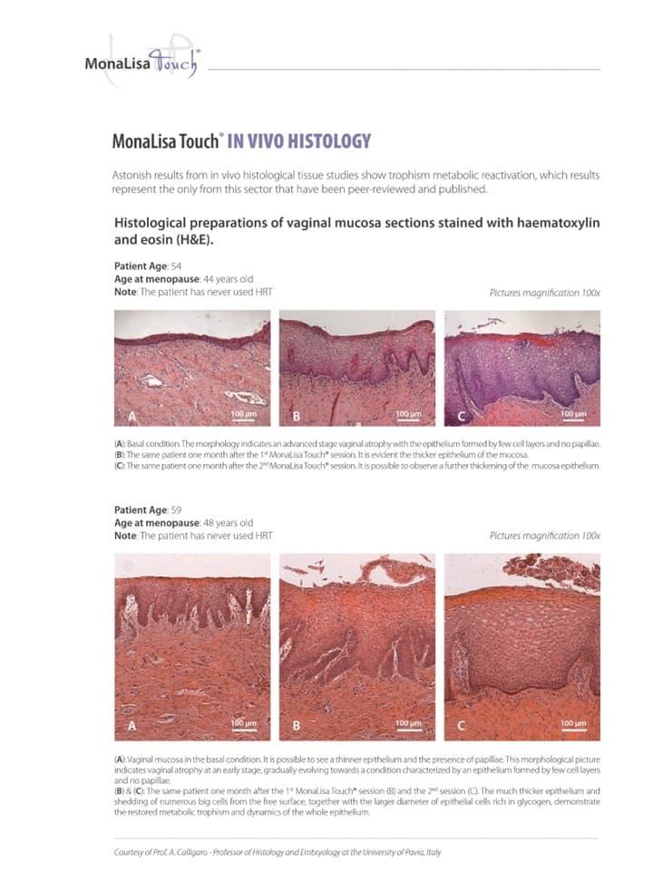 mlt_-_in_vivo_histology.jpg