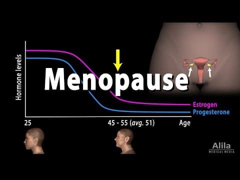 Menopauza