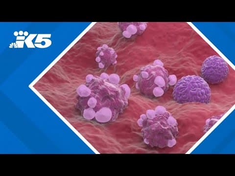 Teški oblici endometrioze povećavaju rizik za rak jajnika