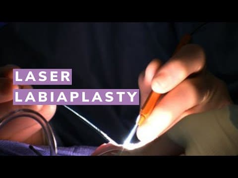 Laserska labioplastika 