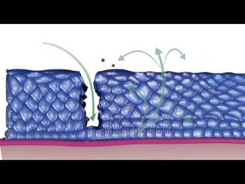 HPV infekcija – simptomi, dijagnoza, rizici i liječenje