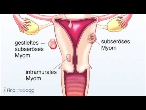 Novi lijek olakšava menstruacijske bolove