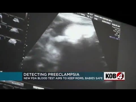Novi krvni test za preeklampsiju: mijenja li PlGF  prenatalnu skrb?
