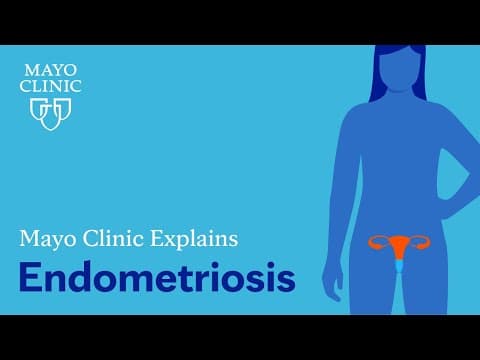 Rizični čimbenici za nastanak endometrioze