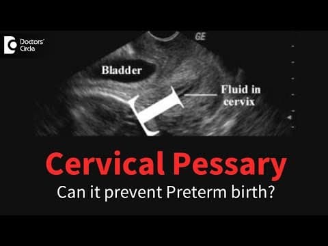 Cervikalni pesar i spontani prijevremeni porod